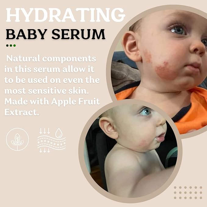 Roe Wellness- Baby Serum Hydrating Skincare Probiotic Protection | Hydrate, Soothe, Clean Ingredients & Safe For All Skin Babies, Infants, Toddlers & Kids (Power Serum)