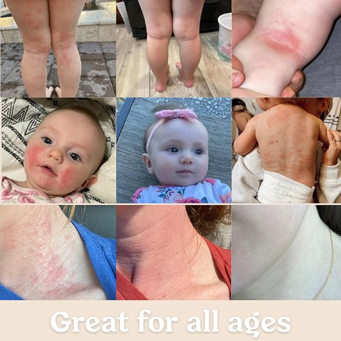 Roe Wellness Baby Cream & Baby Serum Power Pair Biome Barrier | For All Skin & Ages | Hydrating Body, Face, Dry Irritated Skin Toddlers, Newborns Skincare (Power Pair)